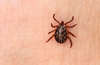 Kayseri’de KKKA şüphesiyle tedavi gören bir kişi hayatını kaybetti