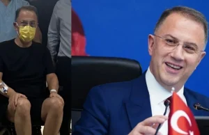 Murat Çalık’a anjiyo yapıldı