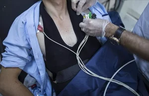 Bakanlıktan hayat kurtaracak adım: Şok cihazı zorunlu hale geliyor